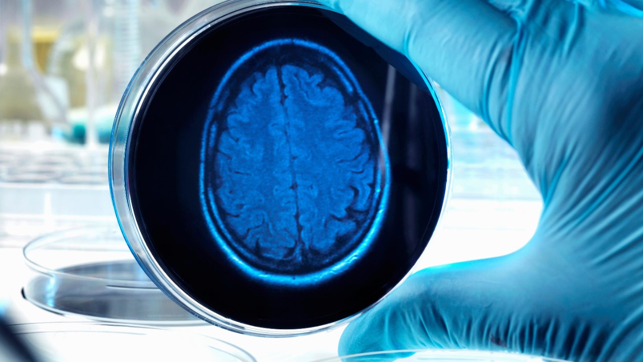 Brain health: Good for you and for business