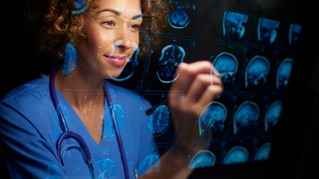 a female doctor or surgeon is analysing the digitally generated scans of a human brain