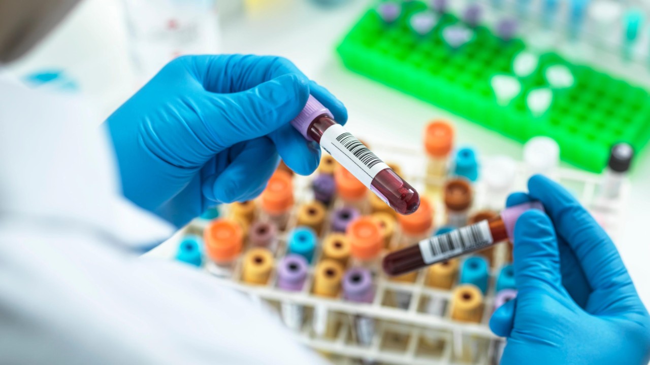 Technician preparing human medical samples for screening.