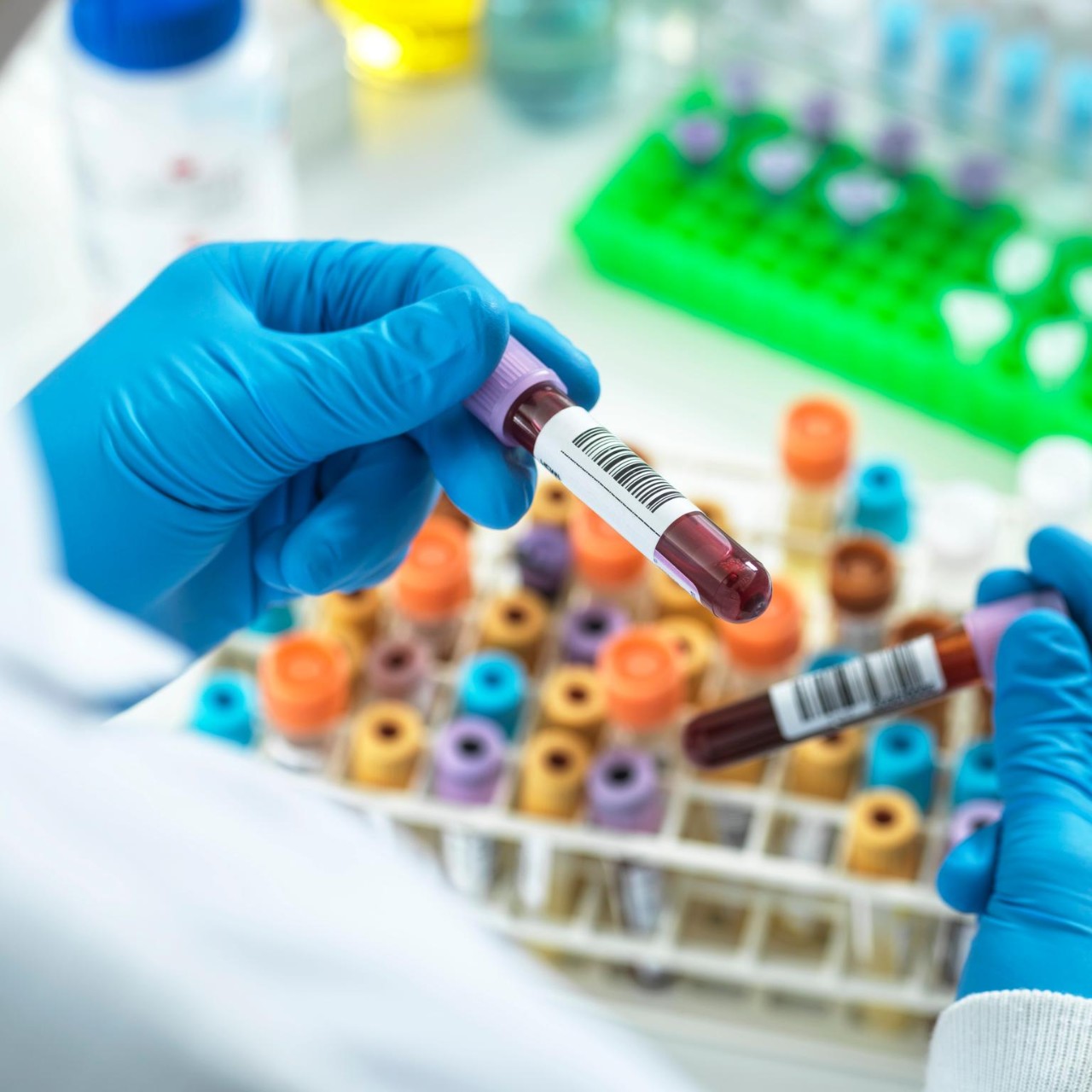 Technician preparing human medical samples for screening.