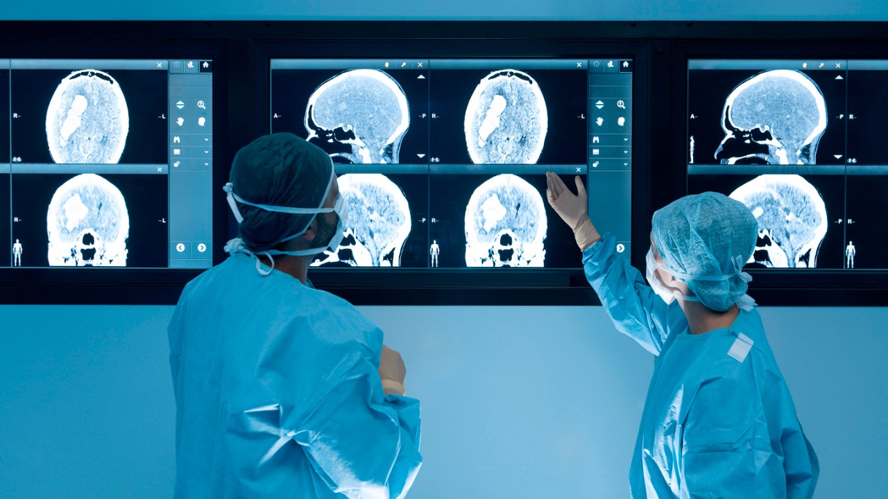 脳手術中に磁気共鳴画像法(MRI)による脳スキャンを調べる外科医。